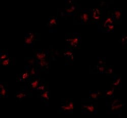 Invitrogen GNPDA1 Polyclonal Antibody 100 &mu;g; Unconjugated:Antibodies,