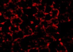 Invitrogen MTCH2 Polyclonal Antibody 100 &mu;g | Buy Online | Invitrogen&trade; | Fisher Scientific