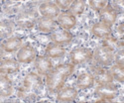 Invitrogen MTCH2 Polyclonal Antibody 100 &mu;g | Buy Online | Invitrogen&trade; | Fisher Scientific