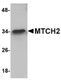 Invitrogen MTCH2 Polyclonal Antibody 100 &mu;g | Buy Online | Invitrogen&trade; | Fisher Scientific
