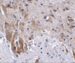 Invitrogen LRFN1 Polyclonal Antibody 100 &mu;g; Unconjugated:Antibodies,