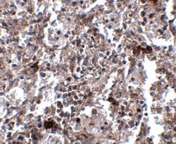 Invitrogen KCTD15 Polyclonal Antibody 100 &mu;g; Unconjugated:Antibodies,