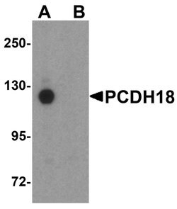 Invitrogen PCDH18 Polyclonal Antibody 100 &mu;g | Buy Online | Invitrogen&trade; | Fisher Scientific