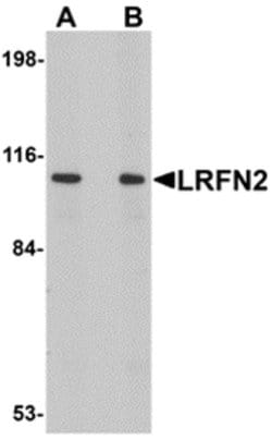 Invitrogen LRFN2 Polyclonal Antibody 100 &mu;g; Unconjugated:Antibodies,