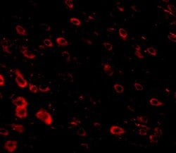 Invitrogen LRFN3 Polyclonal Antibody 100 &mu;g; Unconjugated:Antibodies,