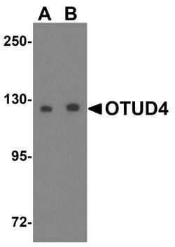 Invitrogen OTUD4 Polyclonal Antibody 100 &mu;g | Buy Online | Invitrogen&trade; | Fisher Scientific