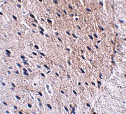 Bora Polyclonal Antibody, Invitrogen 100 &mu;g; Unconjugated:Antibodies