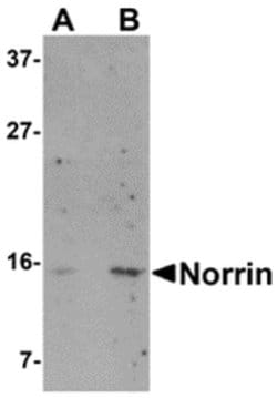 Invitrogen NDP Polyclonal Antibody 100 μg; Unconjugated:Antibodies,