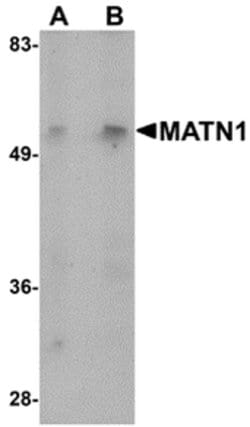 Invitrogen MATN1 Polyclonal Antibody 100 &mu;g | Buy Online | Invitrogen&trade; | Fisher Scientific