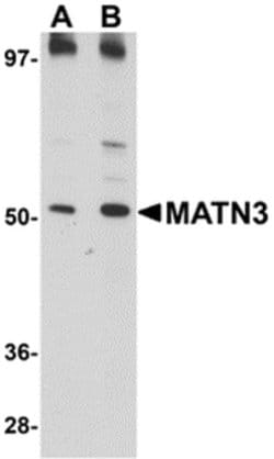 Invitrogen MATN3 Polyclonal Antibody 100 &mu;g; Unconjugated:Antibodies,