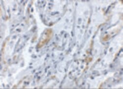 Invitrogen TNFAIP3 Polyclonal Antibody 100 &mu;g | Buy Online | Invitrogen&trade; | Fisher Scientific