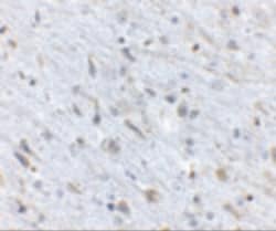 Invitrogen FKBP15 Polyclonal Antibody 100 &mu;g; Unconjugated:Antibodies,