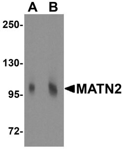 Invitrogen MATN2 Polyclonal Antibody 100 &mu;g; Unconjugated:Antibodies,