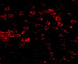 Invitrogen MATN4 Polyclonal Antibody 100 &mu;g; Unconjugated:Antibodies,