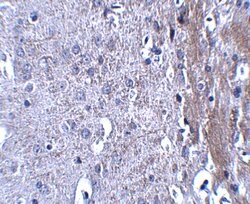 Invitrogen MATN4 Polyclonal Antibody 100 &mu;g; Unconjugated:Antibodies,