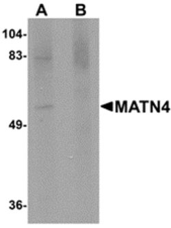 Invitrogen MATN4 Polyclonal Antibody 100 &mu;g; Unconjugated:Antibodies,