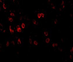 Invitrogen Amyloid Precursor Protein Polyclonal Antibody 100 &mu;g; Unconjugated:Antibodies,