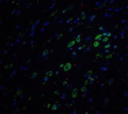 Invitrogen Amyloid Precursor Protein Polyclonal Antibody 100 &mu;g; Unconjugated:Antibodies,