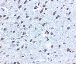 Invitrogen Amyloid Precursor Protein Polyclonal Antibody 100 &mu;g; Unconjugated:Antibodies,