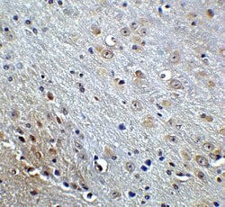 Invitrogen Amyloid Precursor Protein Polyclonal Antibody 100 &mu;g; Unconjugated:Antibodies,