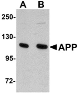 Invitrogen Amyloid Precursor Protein Polyclonal Antibody 100 &mu;g; Unconjugated:Antibodies,