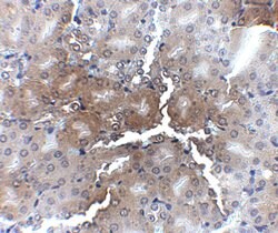 Invitrogen AP2M1 Polyclonal Antibody 100 &mu;g; Unconjugated:Antibodies,