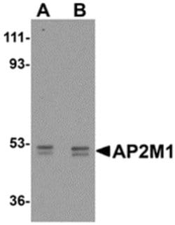 Invitrogen AP2M1 Polyclonal Antibody 100 &mu;g; Unconjugated:Antibodies,