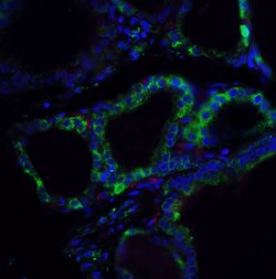 Invitrogen RSPO1 Polyclonal Antibody 100 &mu;g; Unconjugated:Antibodies,