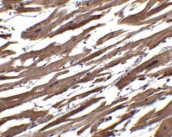 Invitrogen RSPO1 Polyclonal Antibody 100 &mu;g; Unconjugated:Antibodies,