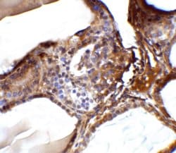 Invitrogen RSPO1 Polyclonal Antibody 100 &mu;g; Unconjugated:Antibodies,