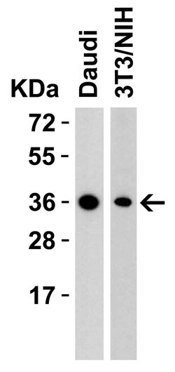 Invitrogen RSPO1 Polyclonal Antibody 100 &mu;g; Unconjugated:Antibodies,