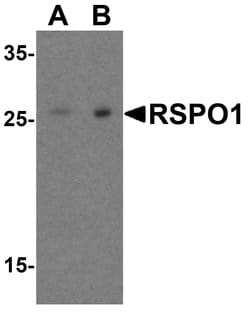 Invitrogen RSPO1 Polyclonal Antibody 100 &mu;g; Unconjugated:Antibodies,
