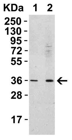 Invitrogen RSPO1 Polyclonal Antibody 100 &mu;g; Unconjugated:Antibodies,