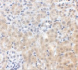 Invitrogen NPC1 Polyclonal Antibody 100 &mu;g; Unconjugated:Antibodies,
