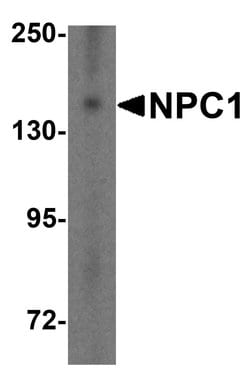 Invitrogen NPC1 Polyclonal Antibody 100 &mu;g; Unconjugated:Antibodies,