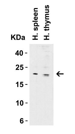 Claudin 1 Polyclonal Antibody, Invitrogen 100 &mu;g; Unconjugated:Antibodies