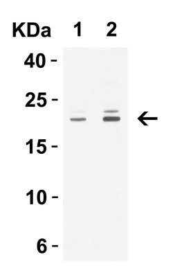 Claudin 1 Polyclonal Antibody, Invitrogen 100 &mu;g; Unconjugated:Antibodies