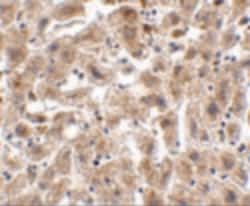 Invitrogen Occludin Polyclonal Antibody 100 &mu;g; Unconjugated:Antibodies,