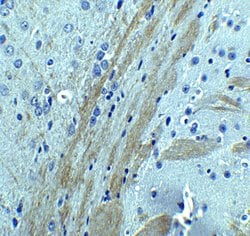 Invitrogen Occludin Polyclonal Antibody 100 &mu;g; Unconjugated:Antibodies,