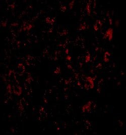 Invitrogen MACC1 Polyclonal Antibody 100 &mu;g | Buy Online | Invitrogen&trade; | Fisher Scientific