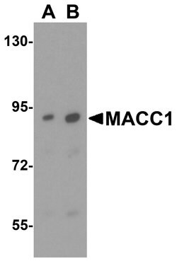 Invitrogen MACC1 Polyclonal Antibody 100 &mu;g | Buy Online | Invitrogen&trade; | Fisher Scientific