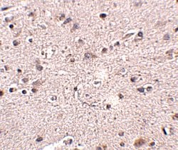 Invitrogen MC4R Polyclonal Antibody 100 &mu;g; Unconjugated:Antibodies,