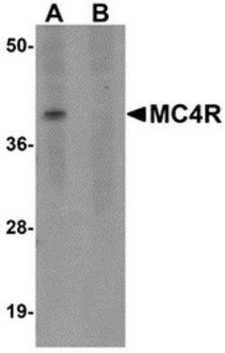 Invitrogen MC4R Polyclonal Antibody 100 &mu;g; Unconjugated:Antibodies,