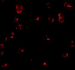 Invitrogen Fibulin 3 Polyclonal Antibody 100 &mu;g; Unconjugated:Antibodies,