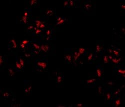 Invitrogen SCARA5 Polyclonal Antibody 100 &mu;g; Unconjugated:Antibodies,