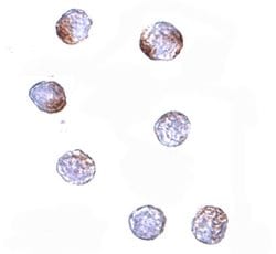 Invitrogen KLHL15 Polyclonal Antibody 100 &mu;g; Unconjugated:Antibodies,