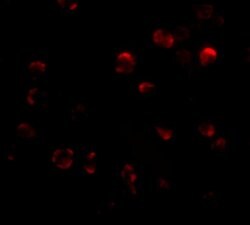 Invitrogen KLHL15 Polyclonal Antibody 100 &mu;g; Unconjugated:Antibodies,