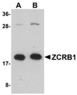 Invitrogen ZCRB1 Polyclonal Antibody 100 &mu;g; Unconjugated:Antibodies,
