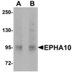 EphA10 Polyclonal Antibody, Invitrogen 100 &mu;g; Unconjugated:Antibodies