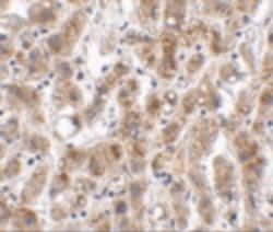 Invitrogen THEM2 Polyclonal Antibody 100 &mu;g; Unconjugated:Antibodies,